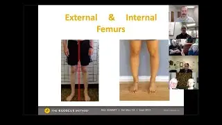 Fix your knee pain by fixing your posture