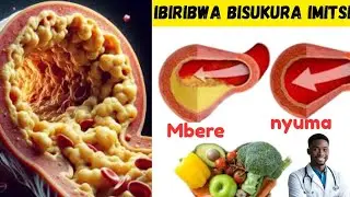 Ibiribwa 10 Bisukura/Bizibura Imitsi itwara amaraso  !! Bikagabanya ibyago byo kurwara Stroke ....