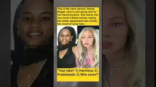 I Was Never Black&rsquo; - Woman&rsquo;s Shocking Transformation Goes Viral! 🤯 #IdentityReveal