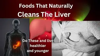 Clean your Liver Naturally by Doing These! #youtubeshorts #viralvideo #wellness #health #viral