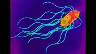 Salmonella Enterica ; Definition, Characteristics, Serotypes, Infections, Symptoms, Treatment