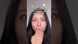 CUTEST star pimple patches!!! ⭐⭐
