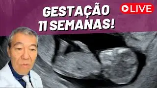 AO VIVO - GESTAÇÃO 11 SEMANAS