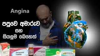 පපුවෙ අමාරුව සහ සියලු බෙහෙත් 😨| Chest pain | treatment for angina in sinhala | papuwe amaruwa