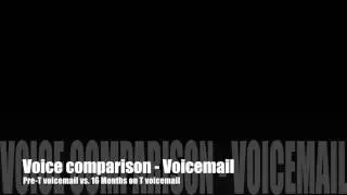 Voicemail comparison: Pre-T - 16 Months on T. My testosterone-fuelled journey #13