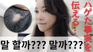 【한일부부/日韓夫婦】부부싸움후에 머리가 빠지기 시작한 남편/夫婦ケンカのストレス？！