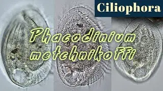 Phacodinium metchnikoffi, moss & lichens ciliate