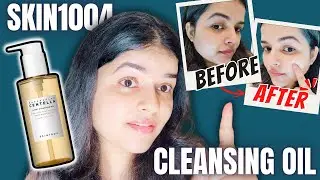 SKIN1004 Madagascar Centella Light Cleansing Oil for Oily & Acne-Prone Skin | Skin1004 Cleansing Oil