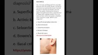 Medicine & Surgery MCQs (For MBBS, USMLE, MCCQE & PLAB)