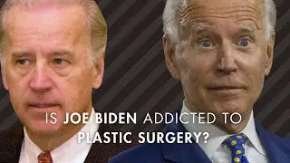 Is Joe Biden Addicted to Plastic Surgery? Plastic Surgeon reacts!