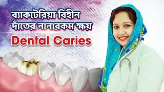 ব্যাকটেরিয়া বিহীন দাঁতের নানারকম ক্ষয় Bacteriafree Dental Caries.Nahid Dental Care Dr Nahid Farzana
