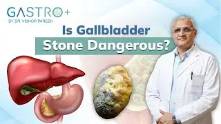 Gallbladder Stone | Symptoms, Surgery & Treatment | Gallbladder stone removal | Dr. Vibhor Pareek