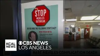 LA County health officials issue public warning after child dies from measles complication