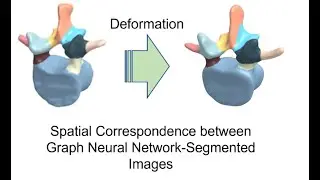 [P090] Spatial Correspondence between Graph Neural Network-Segmented Image