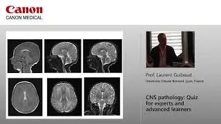 Professor Laurent Guibaud - CNS Pathology: Quiz for Experts and Advanced Learners