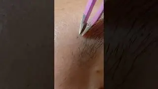 Goodbye, Thick Eyebrow Hair #hairremoval #plucking #tweezers