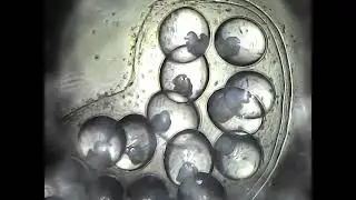 Physella acuta - embryonic development first week.