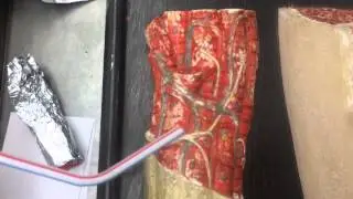 Skeletal Muscle Connective Tissue Wrappings