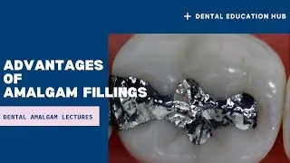 What are Advantages of amalgam fillings ?