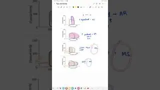 Pressure volume curves cvs |trick to recognise graphs