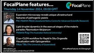 FocalPlane features... Imaging Cell Architecture and Dynamics with JCS
