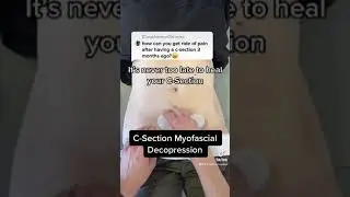 C-section Scar Tissue Mobilizations The Belly Whisperer&reg; Method