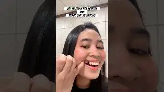 Snap on smile gigi ompong gigi palsu #shortsviral #shortsfeed #shortsvideo #snaponsmile #gigipalsu