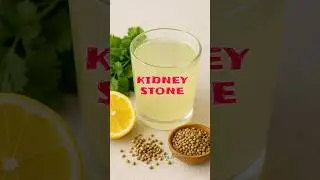 Coriander & Lemon Remedy | Natural Way to Remove Kidney Stones Fast | #shorts #remedy |