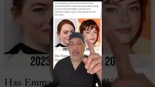 Plastic surgeon reacts to Emma Stone&rsquo;s transformation✨