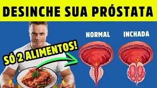 2 ALIMENTOS simples para DESINCHAR sua PR&Oacute;STATA AGORA! Dr Alain Dutra