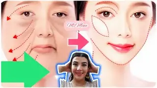 Fat Buccal Removal . Buccal Fat Extraction . Is  Buccal Fat pad  Removal The answer?