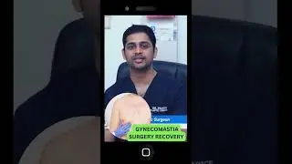 Recovery after gynecomastia surgery (malayalam) || Dr prince plastic surgeon, thrissur