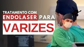 Tratamento com Endolaser para Varizes: como funciona, quem pode fazer e quais s&atilde;o os benef&iacute;cios.