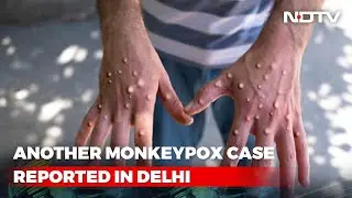 Third Monkeypox Case In Delhi, 8 In India So Far: Health Minister