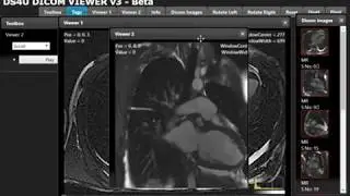 DreamSoft4u DICOM - PACS Imaging Solution