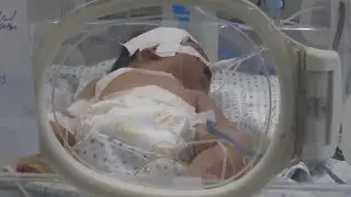 Gaza maternity ward team struggling amid increase in number of premature births