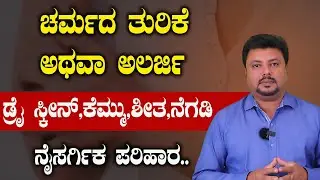 ಯಾವುದೇ ಚರ್ಮದ ಅಲರ್ಜಿಗಳಿಗೆ ಮೂಲ ಕಾರಣ IgE ನಿಯಂತ್ರಿಸುವುದು ಹೇಗೆ.? Skin Allergy In Kannada | Skin Rashes