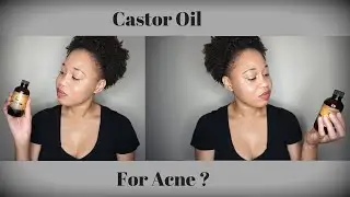 Castor Oil For Acne  Benefits and How To Use It  Euniycemari