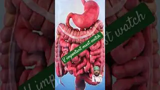 life with ulcerative colitis |ibd |😱😱😱😱#shorts