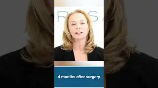 How Postoperative Swelling Improves Facelift Results, but Doesn't Last #facelift