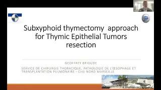 Subxyphoid Thymectomy Approach for Thymic Epithelial Tumor Resection