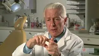 Dr  Dan Fischer   History of Ultrapak knitted retraction cord