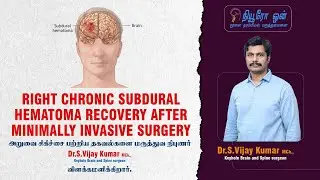 Minimally Invasive Surgery SAVED My Life! Full Recovery from Chronic Subdural Hematoma