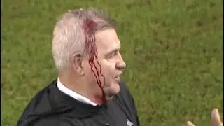 Honduras Mexico Final del Partido, le abren la cabeza al Vasco Aguirre Verg&uuml;enza Total. 15/11/24