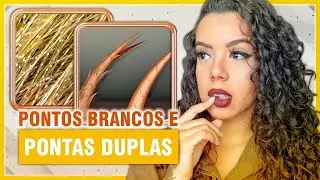 PONTAS DUPLAS E BOLINHAS BRANCAS NO CABELO - TRICOPTILOSE E TRICORREXIS NODOSA - Tamires Maia