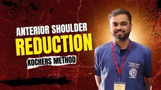 KOCHER&rsquo;S METHOD OF ANTERIOR SHOULDER DISLOCATION REDUCTION. #emergency#trauma#ortho#firstaid 