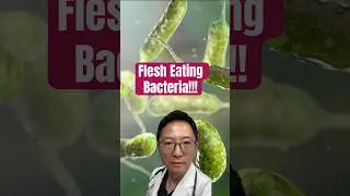 Deadly Flesh-Eating Bacteria in Ocean Water?! Vibrio Infections Rising #medicine