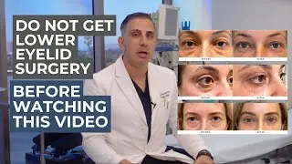 The truth about lower lid blepharoplasty : what your surgeon should be telling you