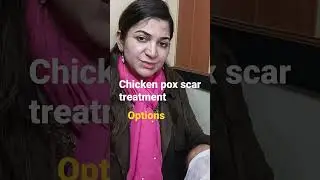 Chicken Pox Scar Treatment By Laser / Filler | Remove Chicken Pox Scars From Face Hindi Aisha Ghias