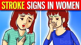 10 UNUSUAL Stroke Signs In Women That Should NEVER Be Ignored!